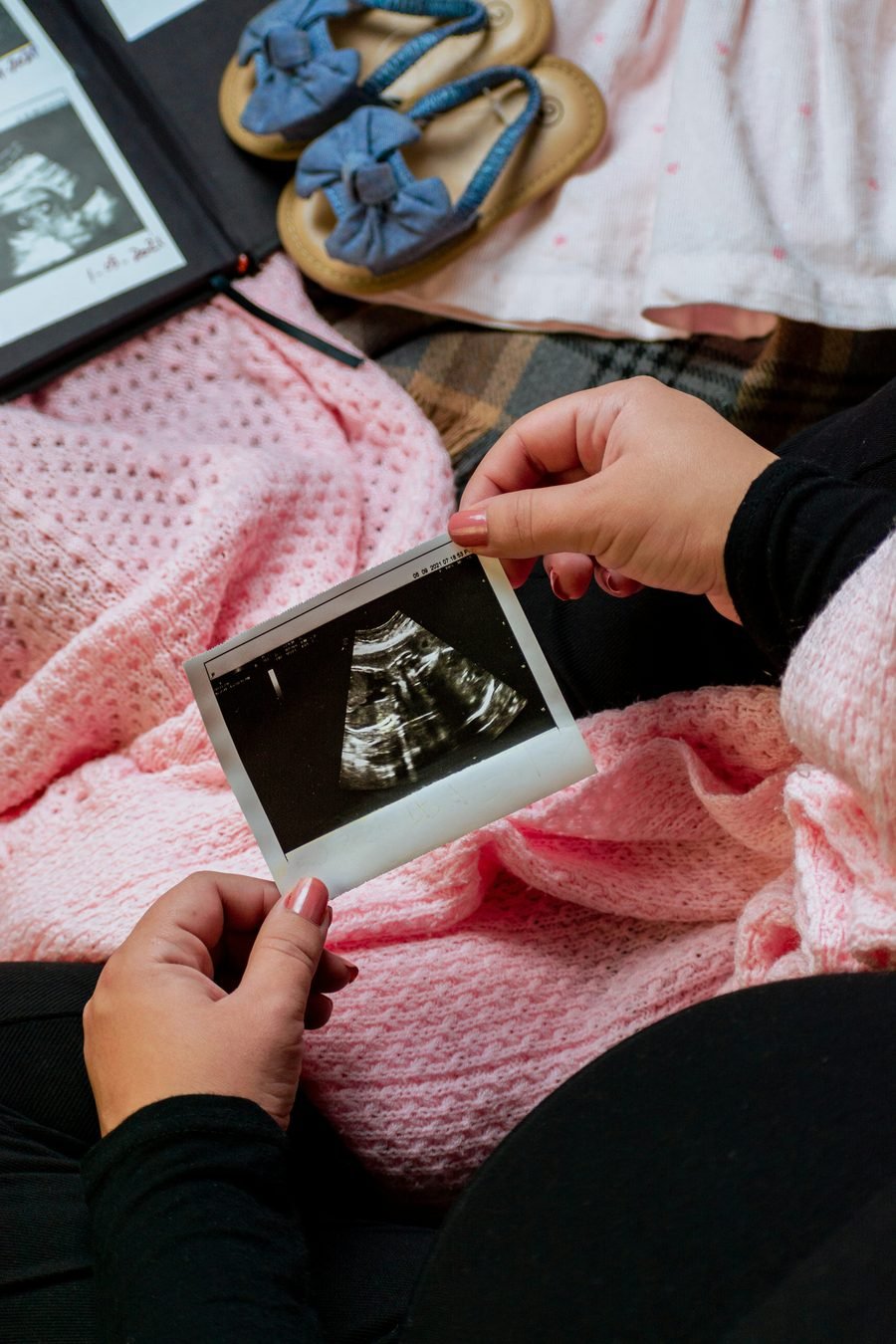 Mamá sosteniendo la imagen de la sonografía de su bebé